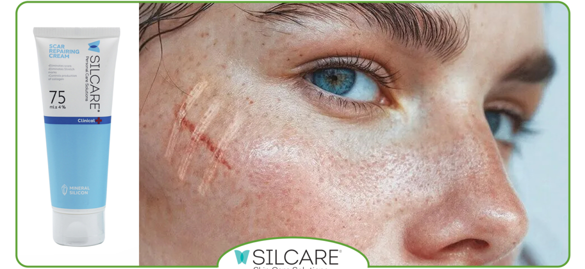 کرم ترمیم کننده خوب برای جای بخیه