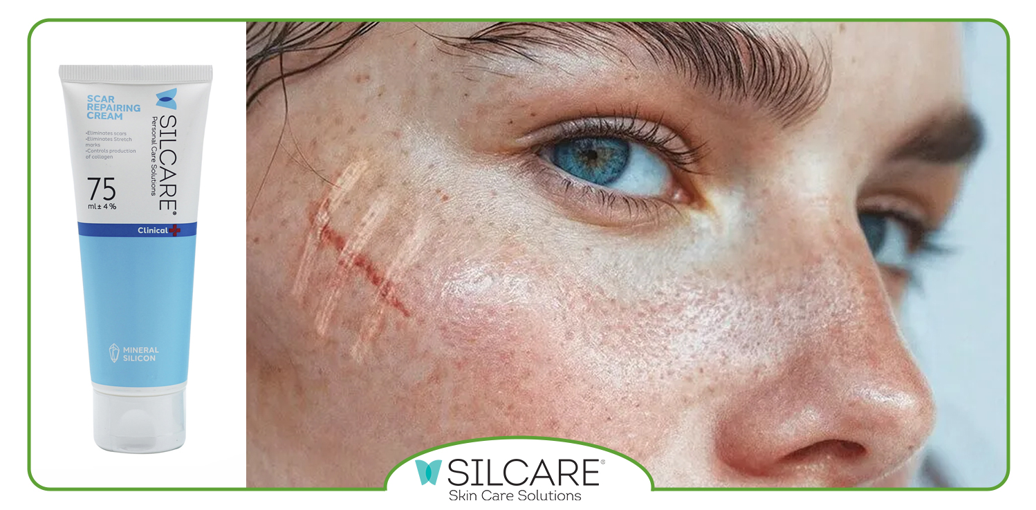 کرم ترمیم کننده خوب برای جای بخیه