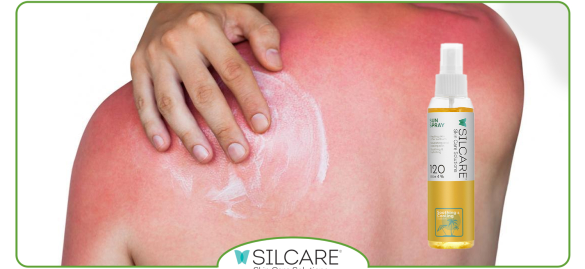 اسپری سولار چیست و چرا برای مراقبت روزانه پوست ضروری است؟