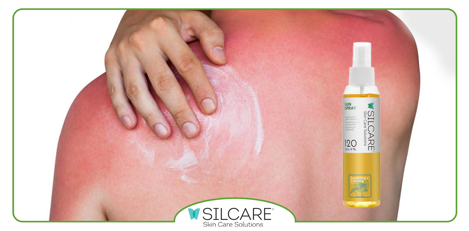 اسپری سولار چیست و چرا برای مراقبت روزانه پوست ضروری است؟