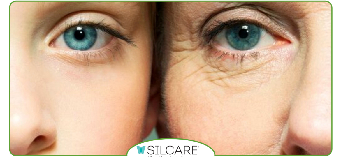 بررسی تاثیر سرم سیلکر در کاهش خطوط ریز پوست