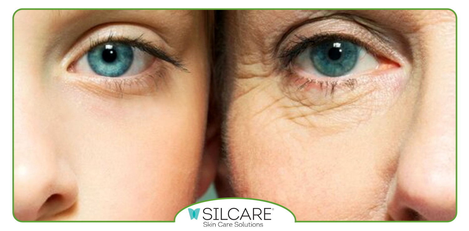 بررسی تاثیر سرم سیلکر در کاهش خطوط ریز پوست