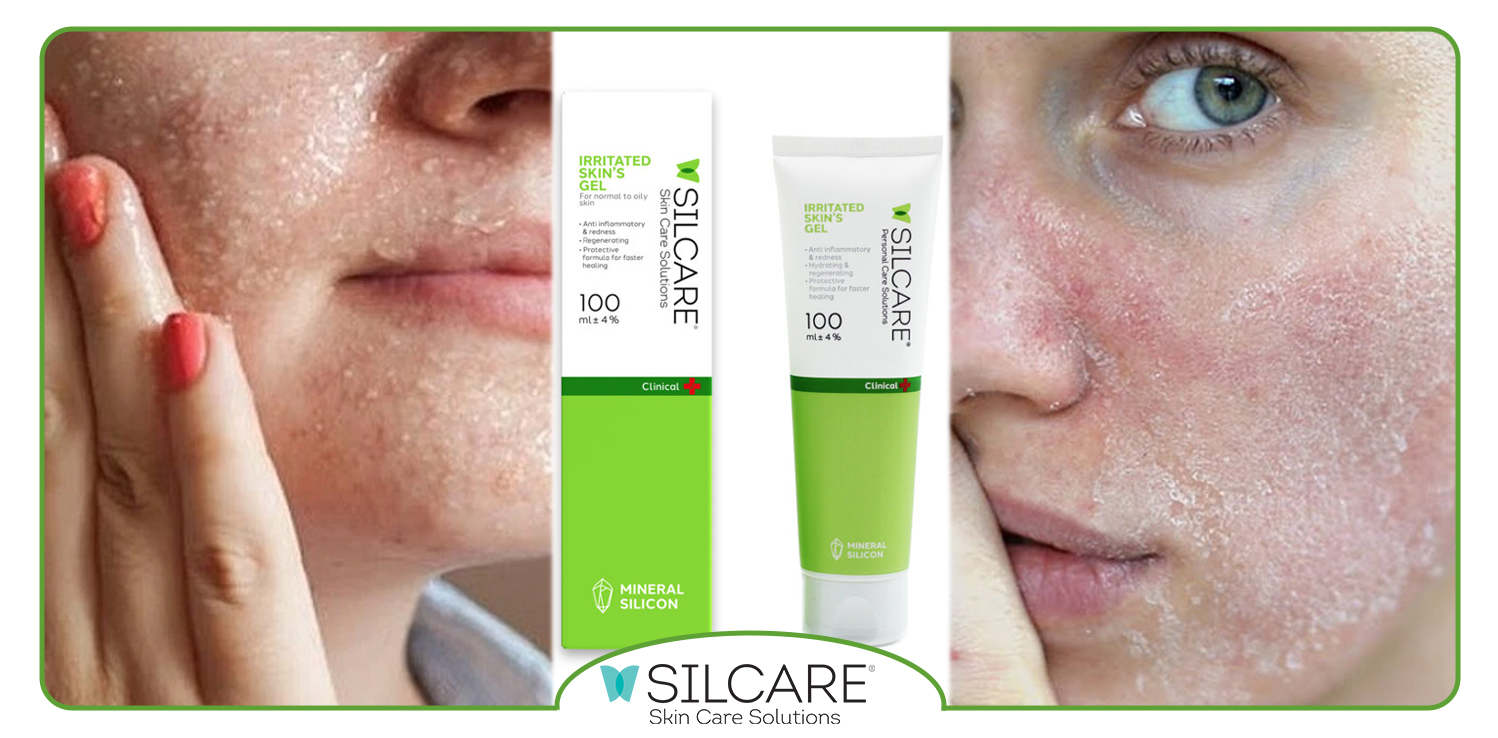 مواد تشکیل دهنده ژل ترمیم کننده پوست آسیب دیده سیلکر