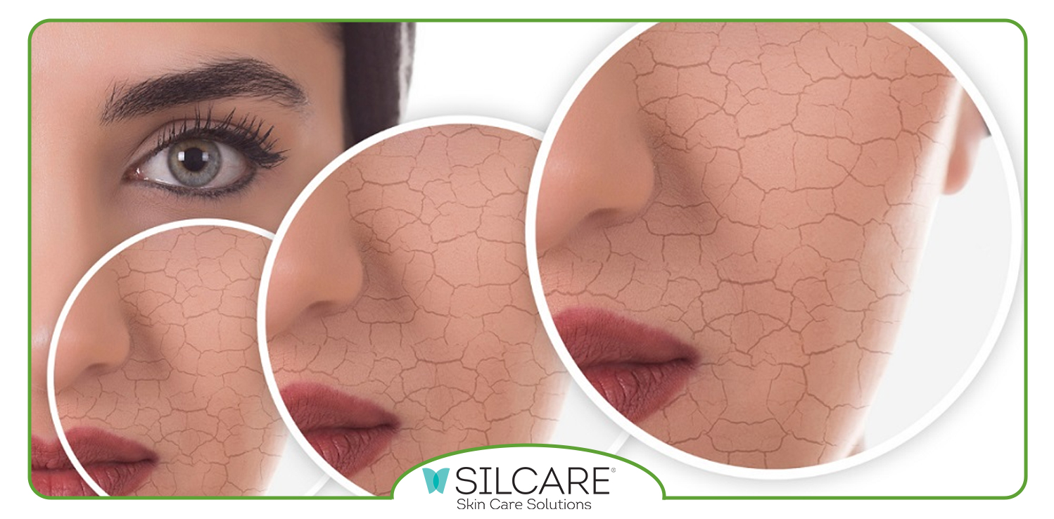 ویژگی های ژل شست و شوی پوست خشک سیلکر