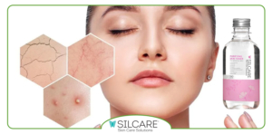 چگونه از تونر سیلکر برای پاکسازی ملایم پوست حساس استفاده کنیم؟