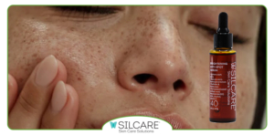 استراتژی موثر استفاده از سرم ضد لک برای نتیجه پایدار