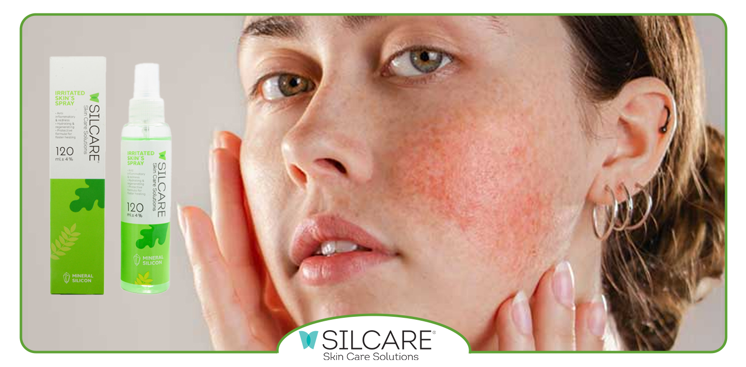 اسپری ترمیم کننده سیلکر چه ویژگی ‌هایی دارد؟