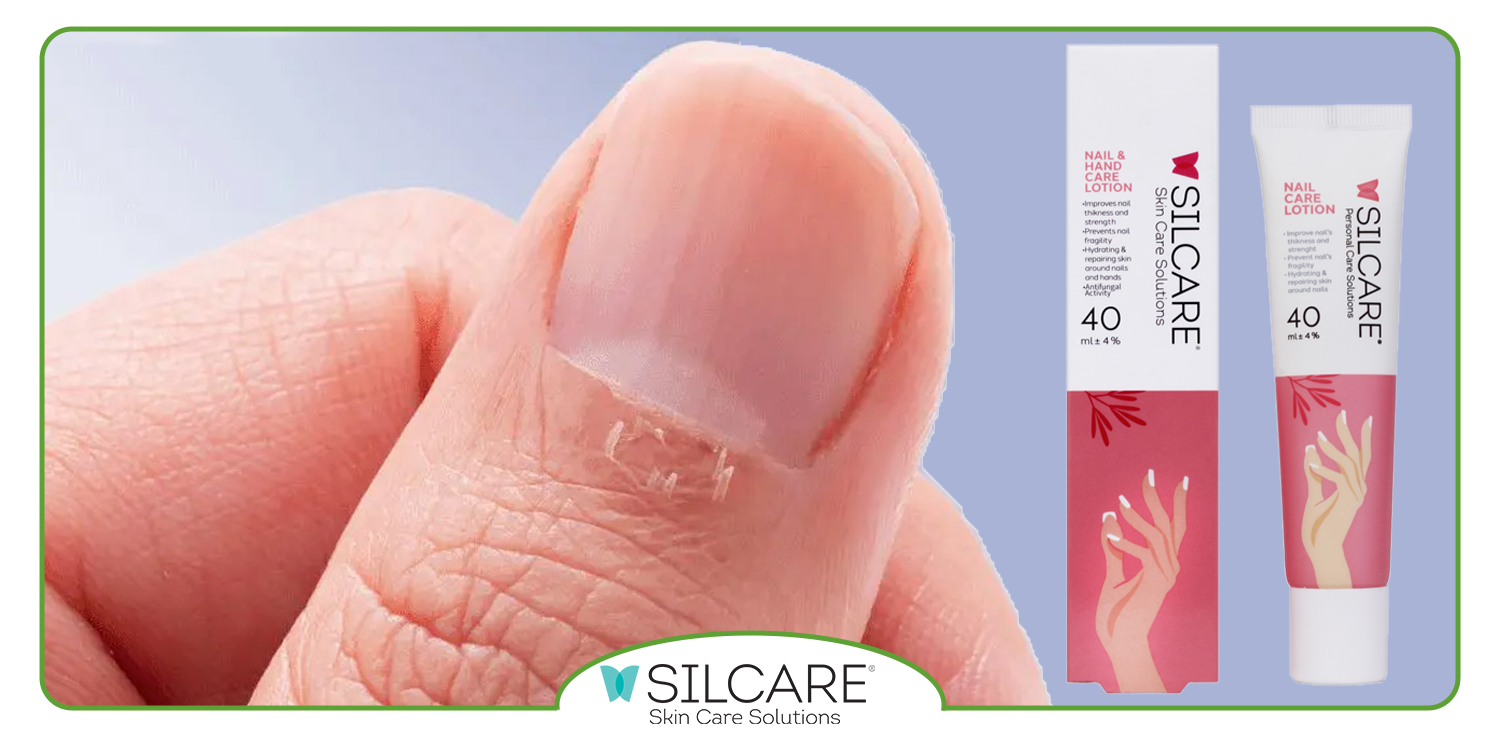 اهمیت استفاده از لوسیون ناخن سیلکر