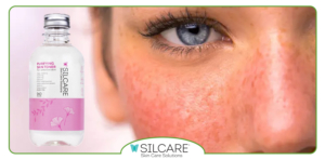 کدام ترکیبات تونر التهاب و قرمزی پوست حساس را کاهش می‌ دهند؟