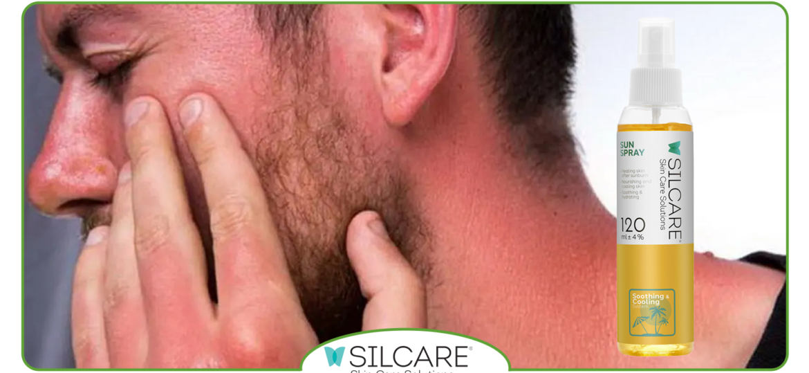 نکات ایمنی هنگام استفاده از محصولات سولار