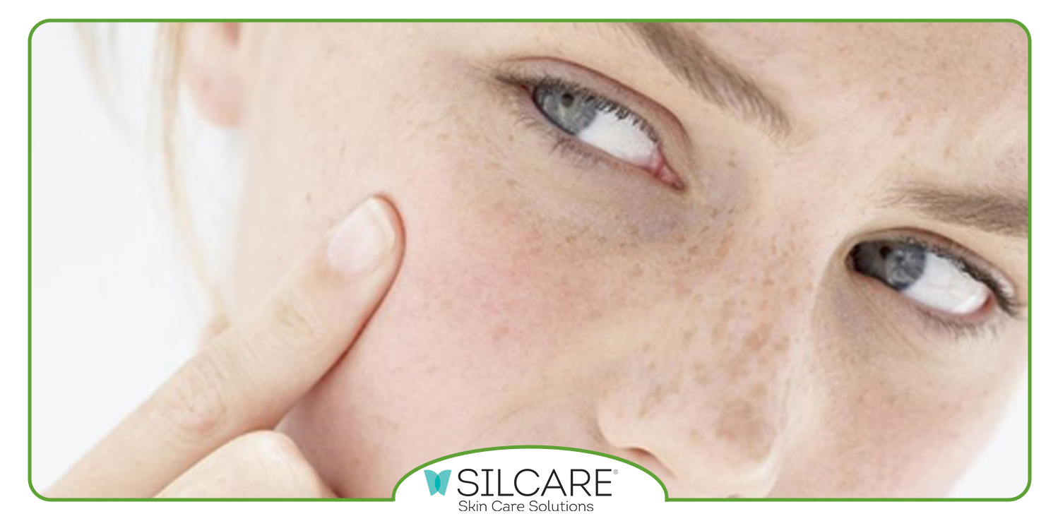 نکات کلیدی برای استفاده از سرم ضد لک سیلکر