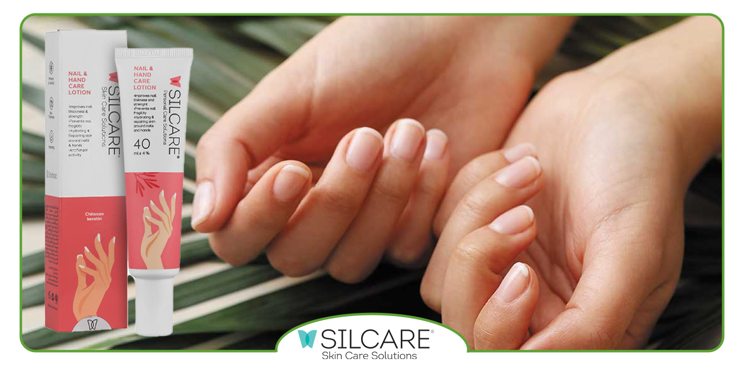 چگونه-لوسیون-دست-از-پوسته‌-پوسته-شدن-اطراف-ناخن-جلوگیری-می-‌کند؟