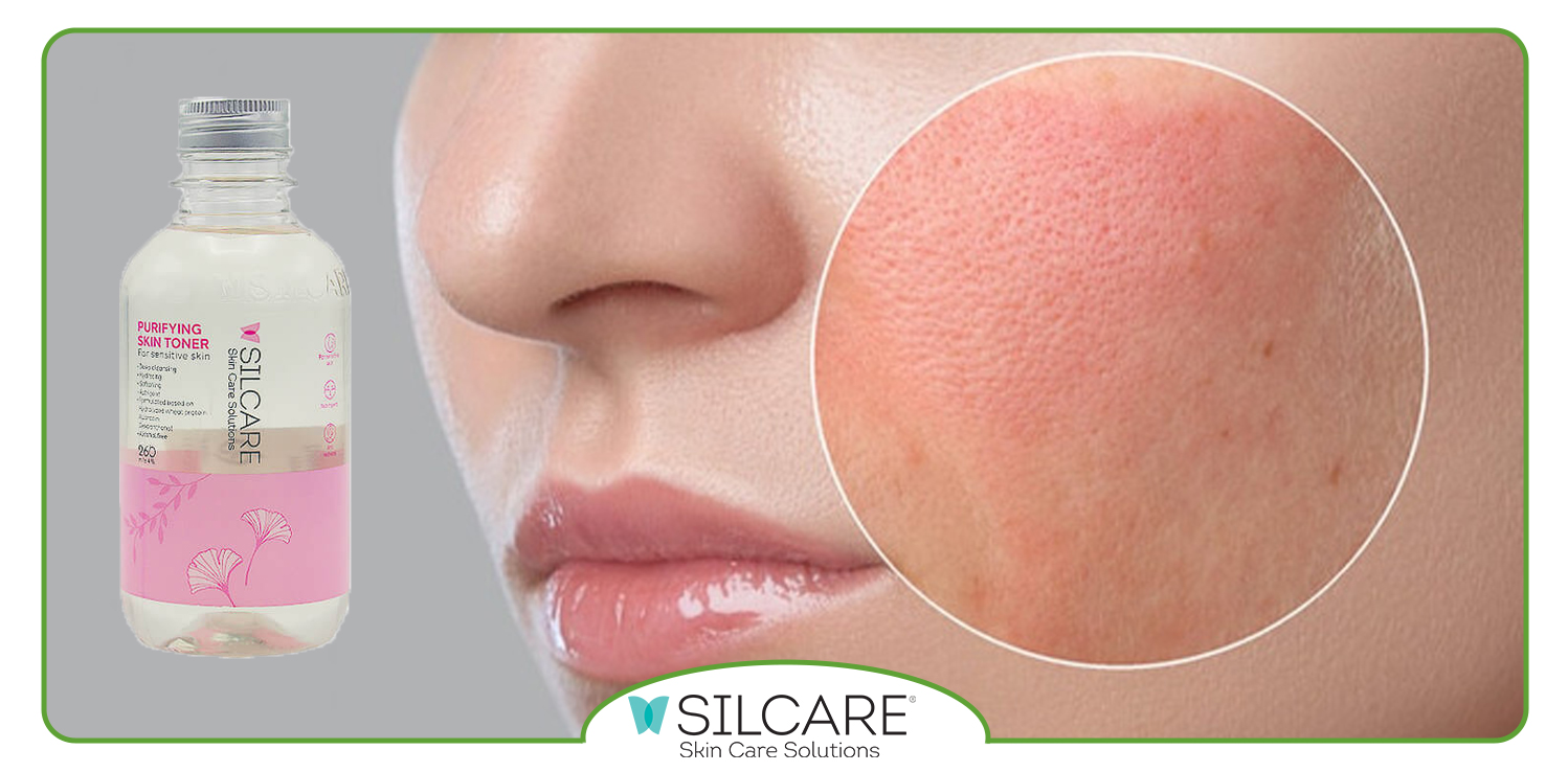 کدام ترکیب در تونر پوست حساس سیلکر به کاهش قرمزی پوست کمک زا است؟