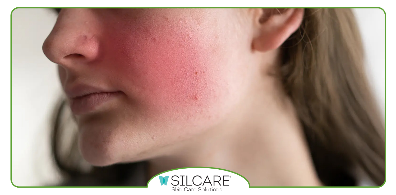 آیا بعد از استفاده از تونر باید صورت را شست؟