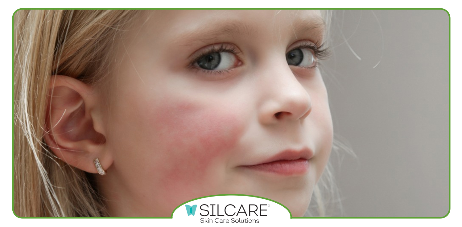 آیا بعد از استفاده از تونر باید صورت را شست؟