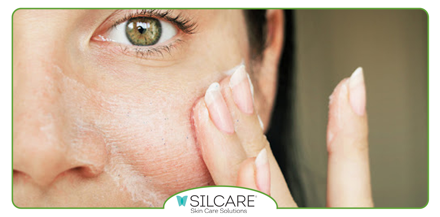 اسپری ترمیم کننده