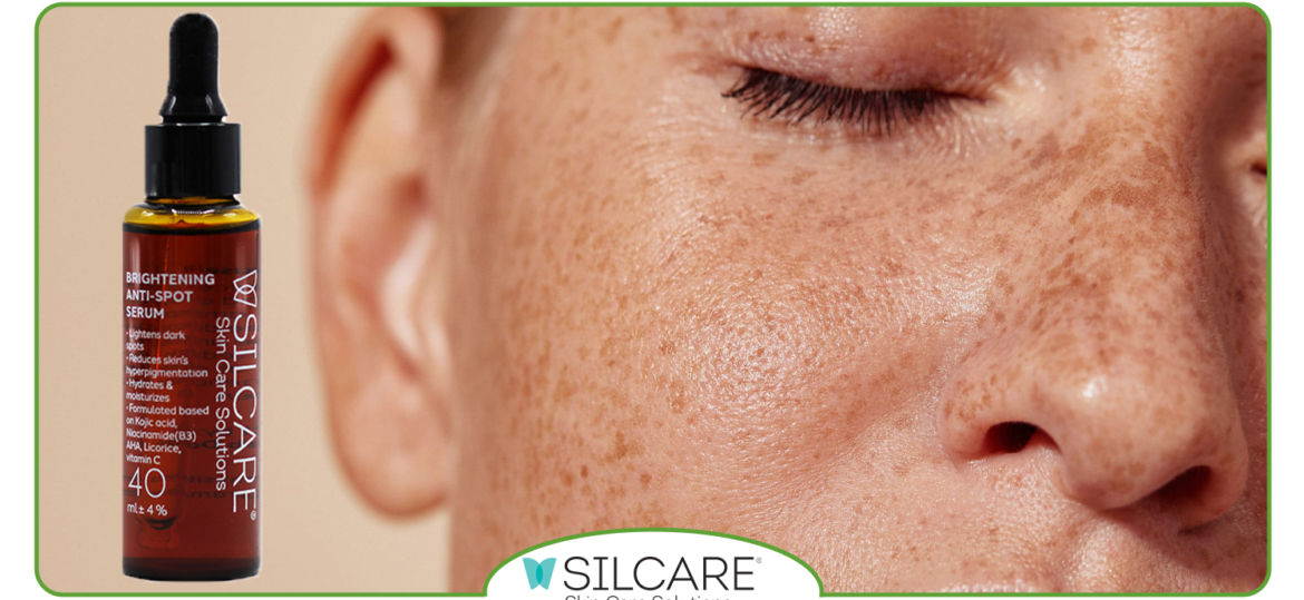 انتخاب سرم ضد لک مناسب برای پوست‌ هایی با لکه‌ های ناشی از آفتاب