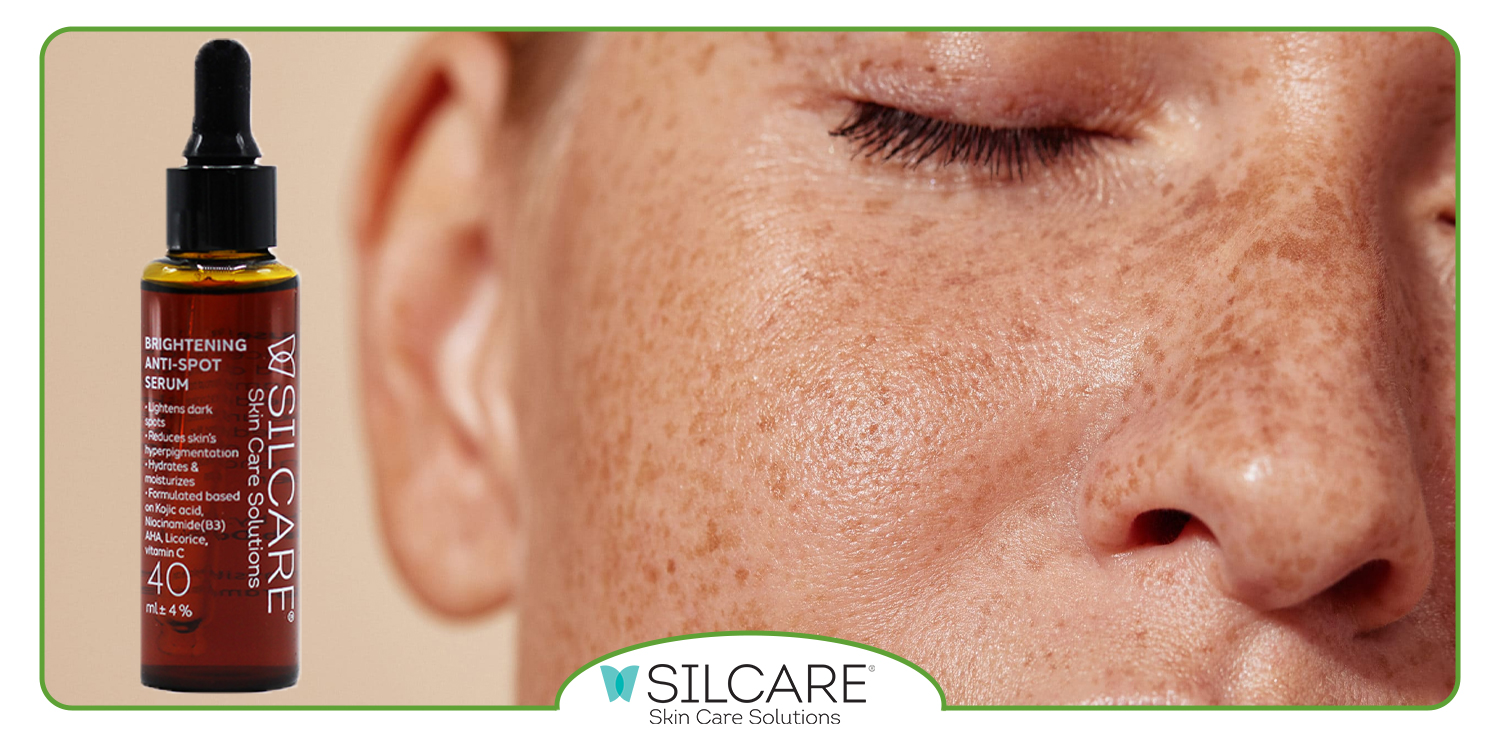 انتخاب سرم ضد لک مناسب برای پوست‌ هایی با لکه‌ های ناشی از آفتاب