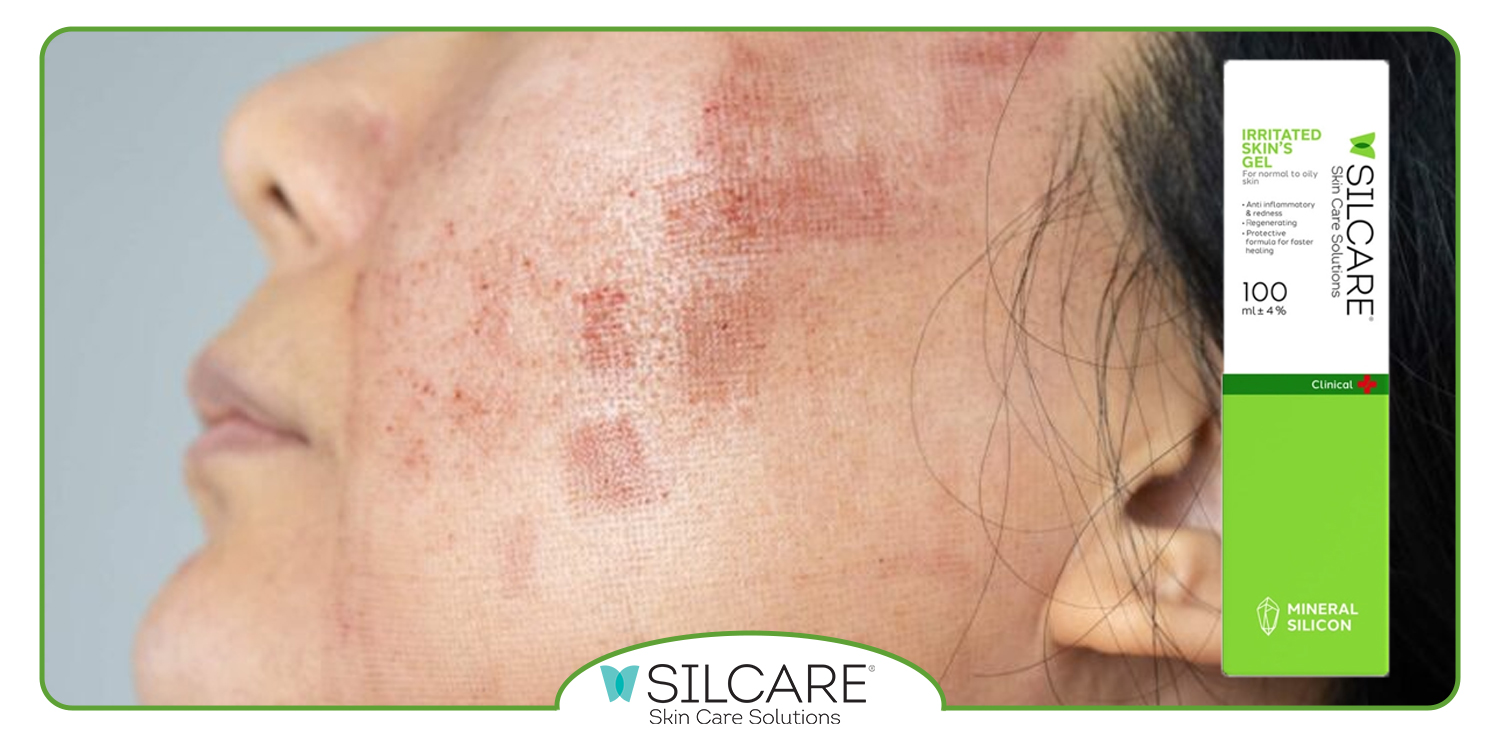 ترتیب اصولی استفاده از محصولات پوستی در روتین صبح پوست