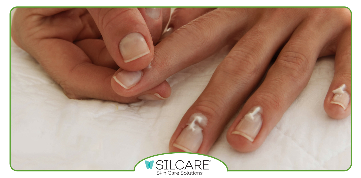 ترکیبات لوسیون مراقبت از دست و ناخن سیلکر