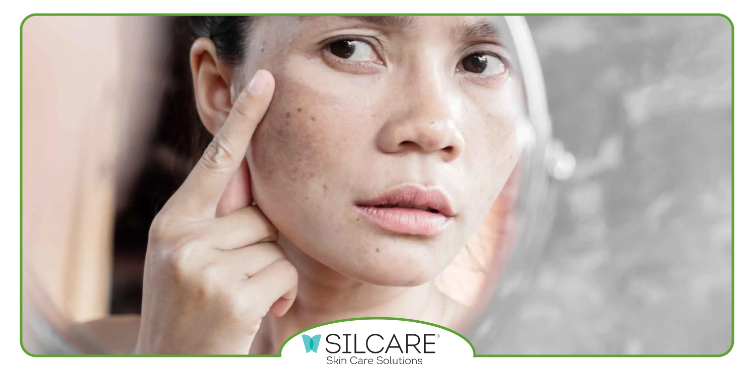 دلایل استفاده از ترمیم کننده پوست