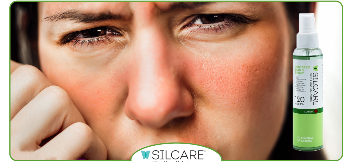 راهنمای انتخاب اسپری ترمیمی مناسب براساس نوع آسیب