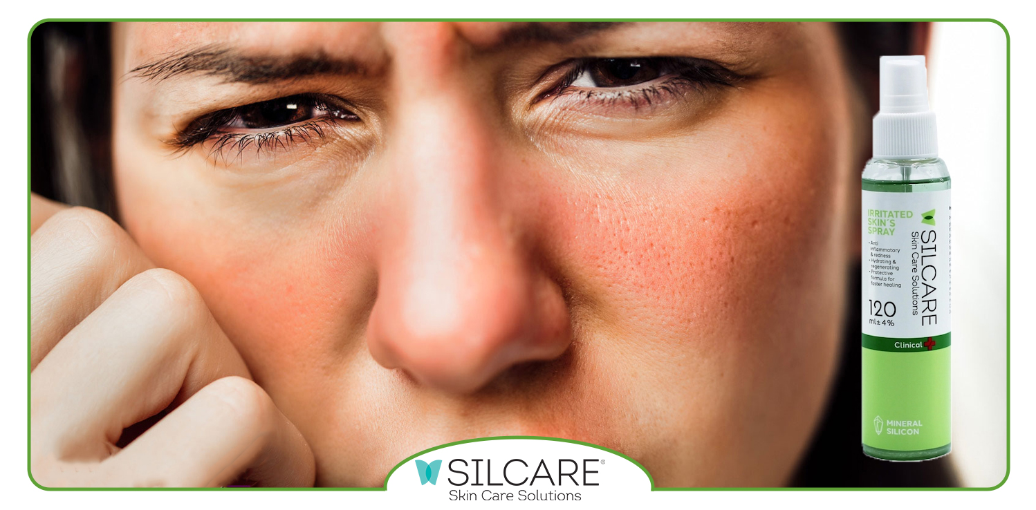 راهنمای انتخاب اسپری ترمیمی مناسب براساس نوع آسیب