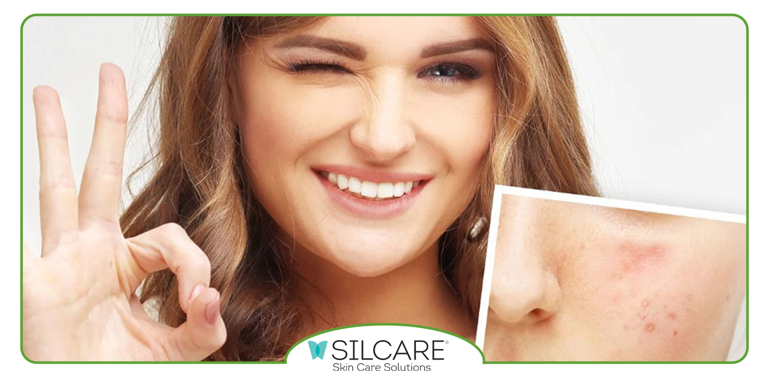 زمان استفاده از ژل ترمیم کننده در روتین پوستی