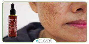 چگونه سرم ضد لک را با روتین شبانه هماهنگ کنیم؟