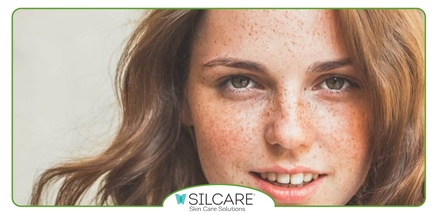 عملکرد ویتامین C در سرم ضد لک سیلکر