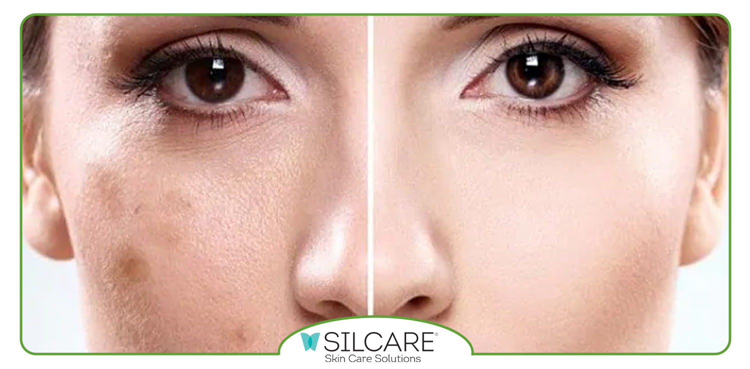 نکات ایمنی در مصرف ژل ترمیم کننده سیلکر