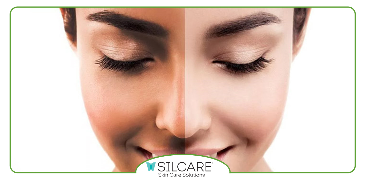 نکات تکمیل کننده برای برنزه کردن پوست