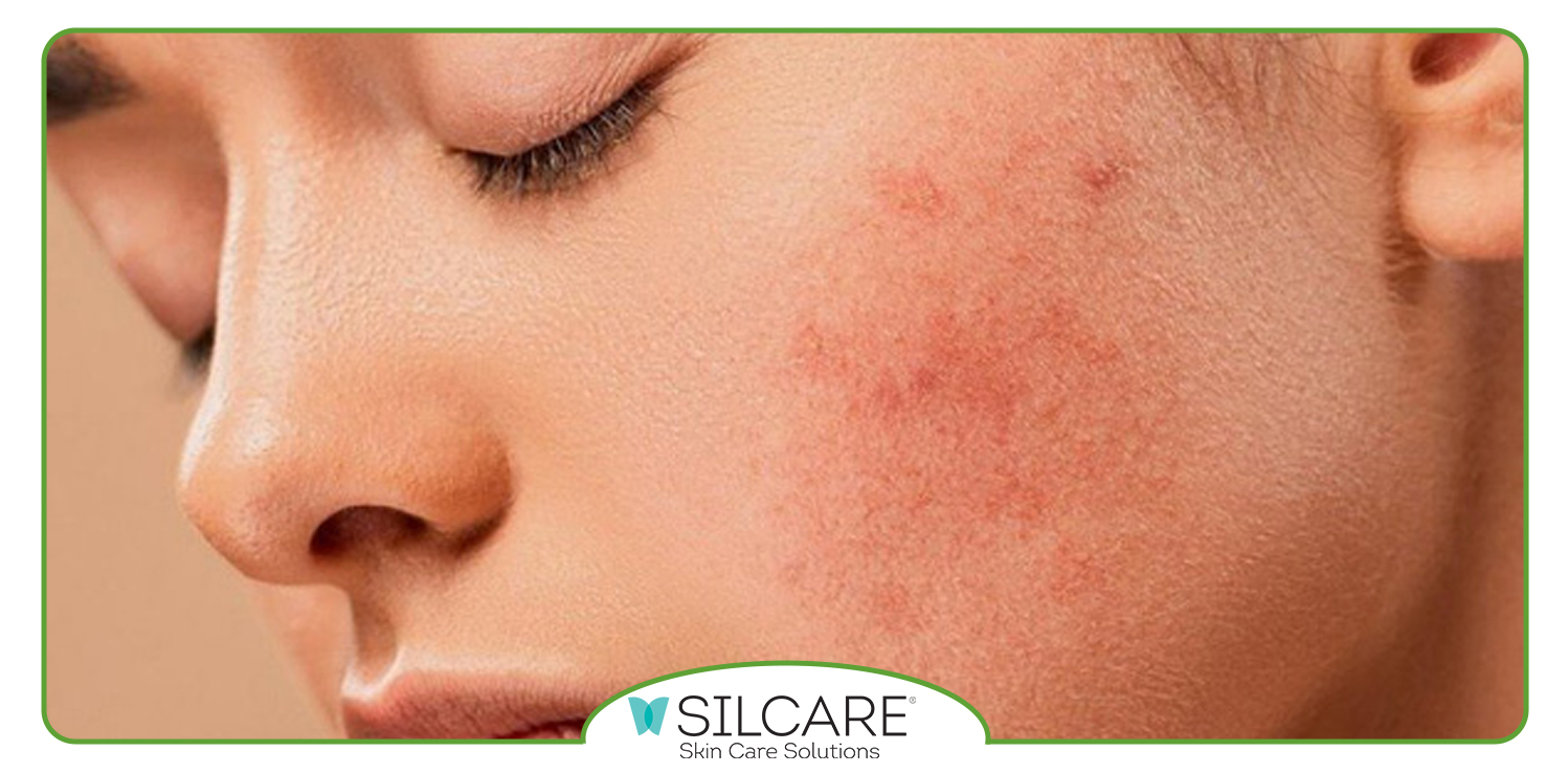 نکاتی مهم برای قبل از خرید ترمیم کننده پوست