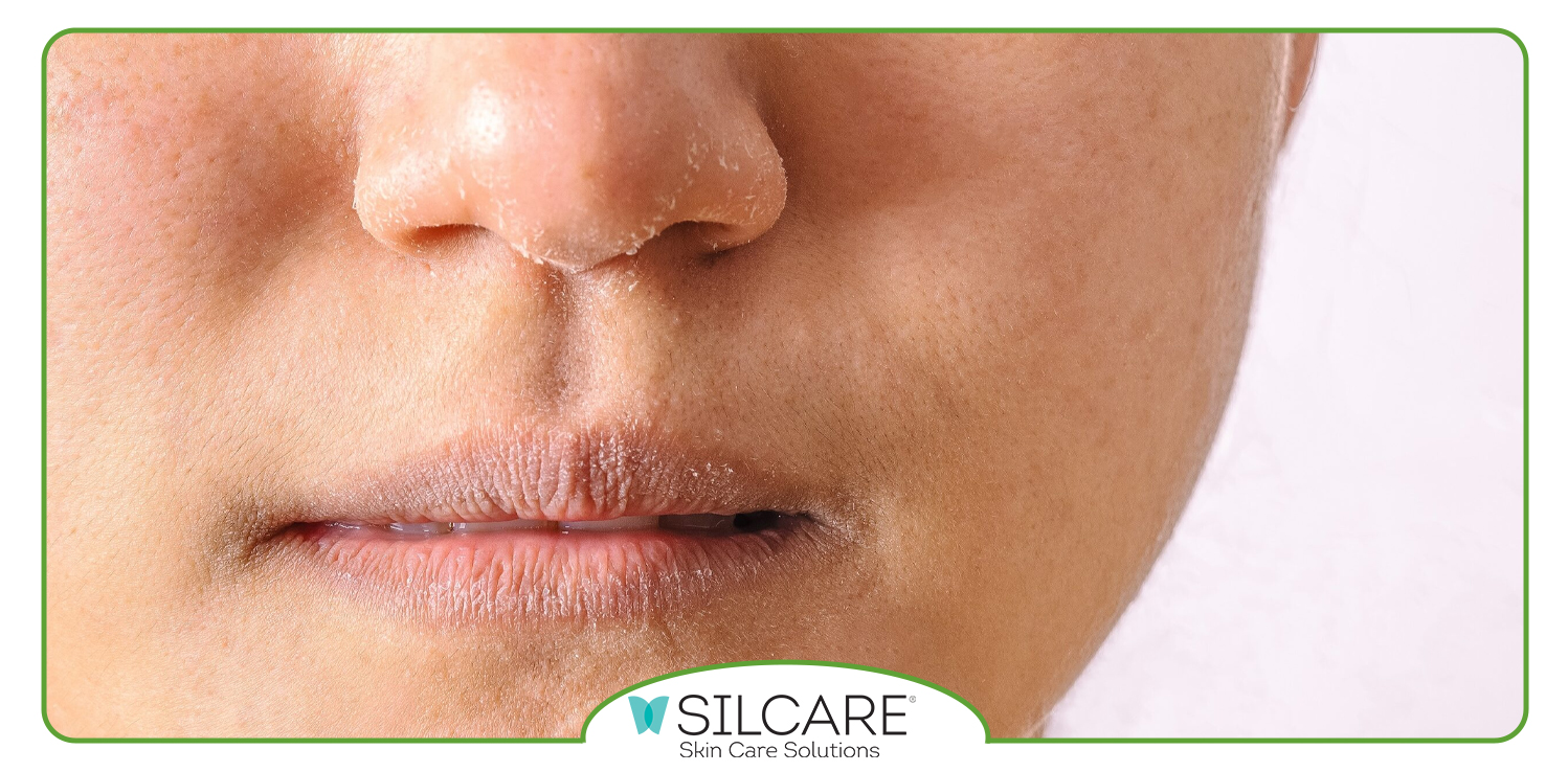 ویژگی‌ های تونر پوست خشک سیلکر