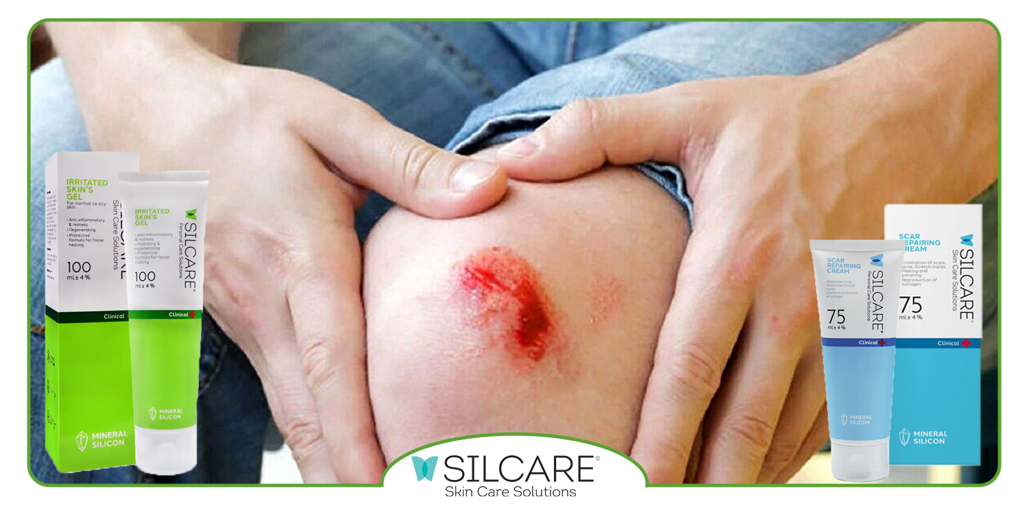 چرا-ژل-ترمیم-‌کننده-در-بازسازی-پوست-بهتر-از-کرم-عمل-می‌-کند