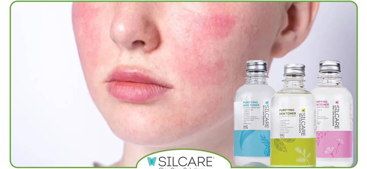 چگونه تونر مناسب از قرمزی و کشیدگی پوست جلوگیری می‌ کند؟