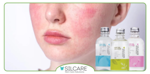 چگونه تونر مناسب از قرمزی و کشیدگی پوست جلوگیری می‌ کند؟