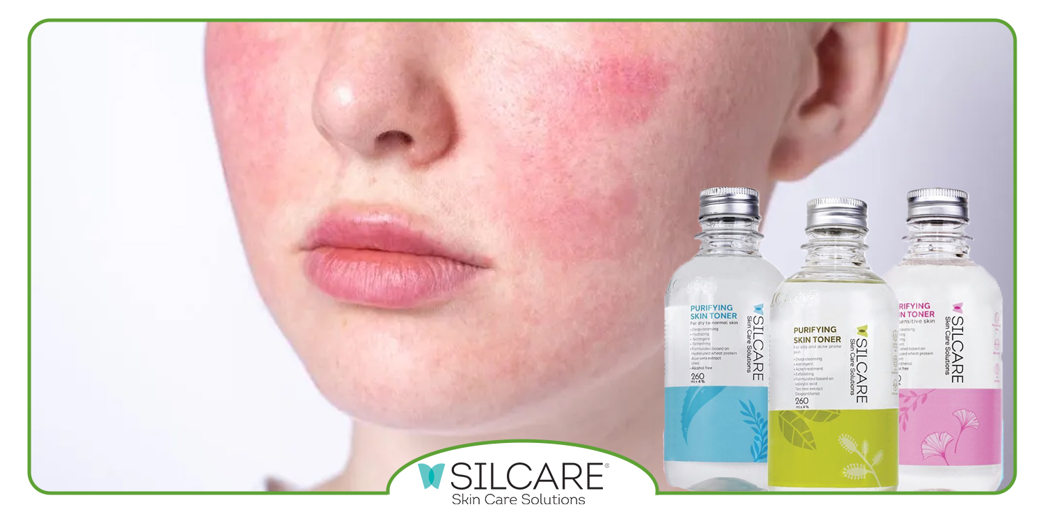 چگونه تونر مناسب از قرمزی و کشیدگی پوست جلوگیری می‌ کند؟