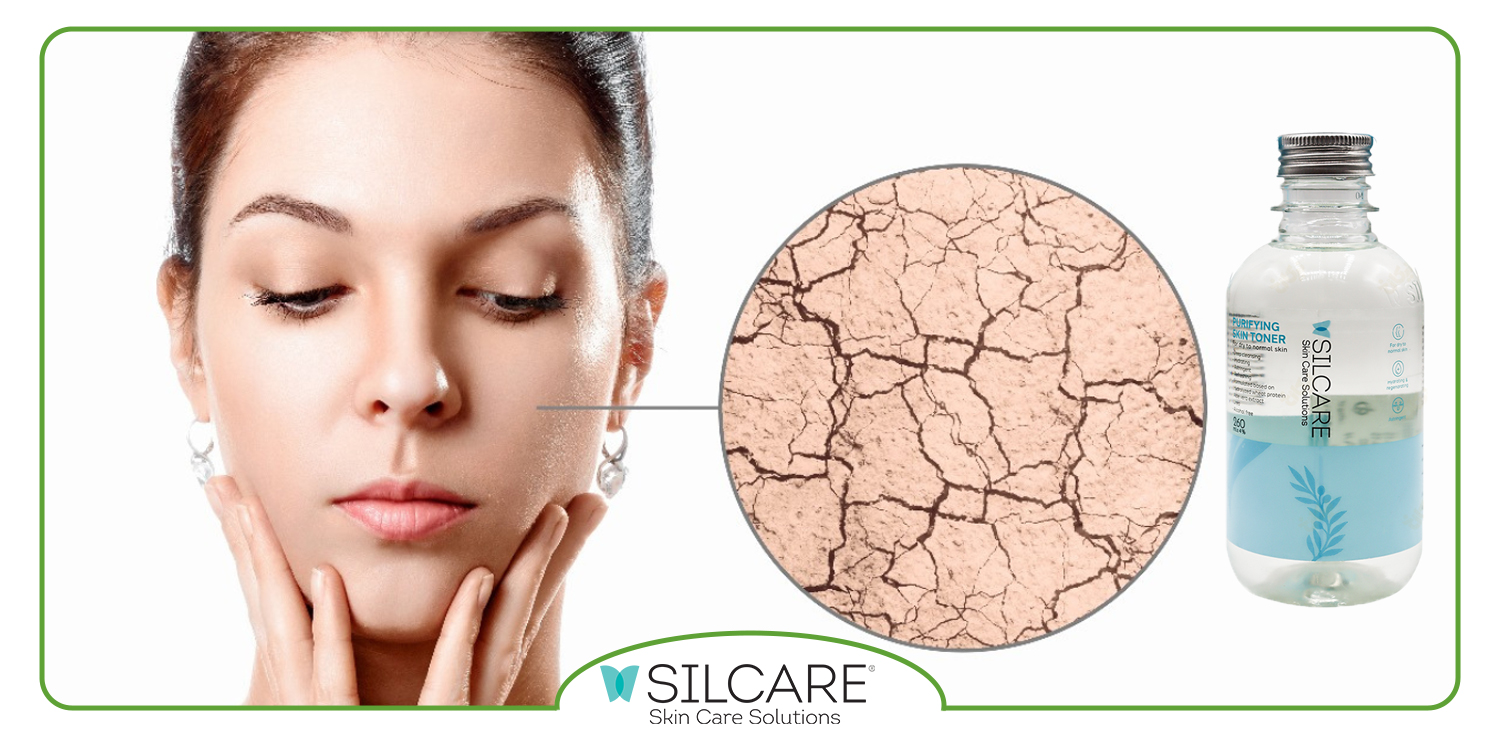 کاهش جوش و آکنه