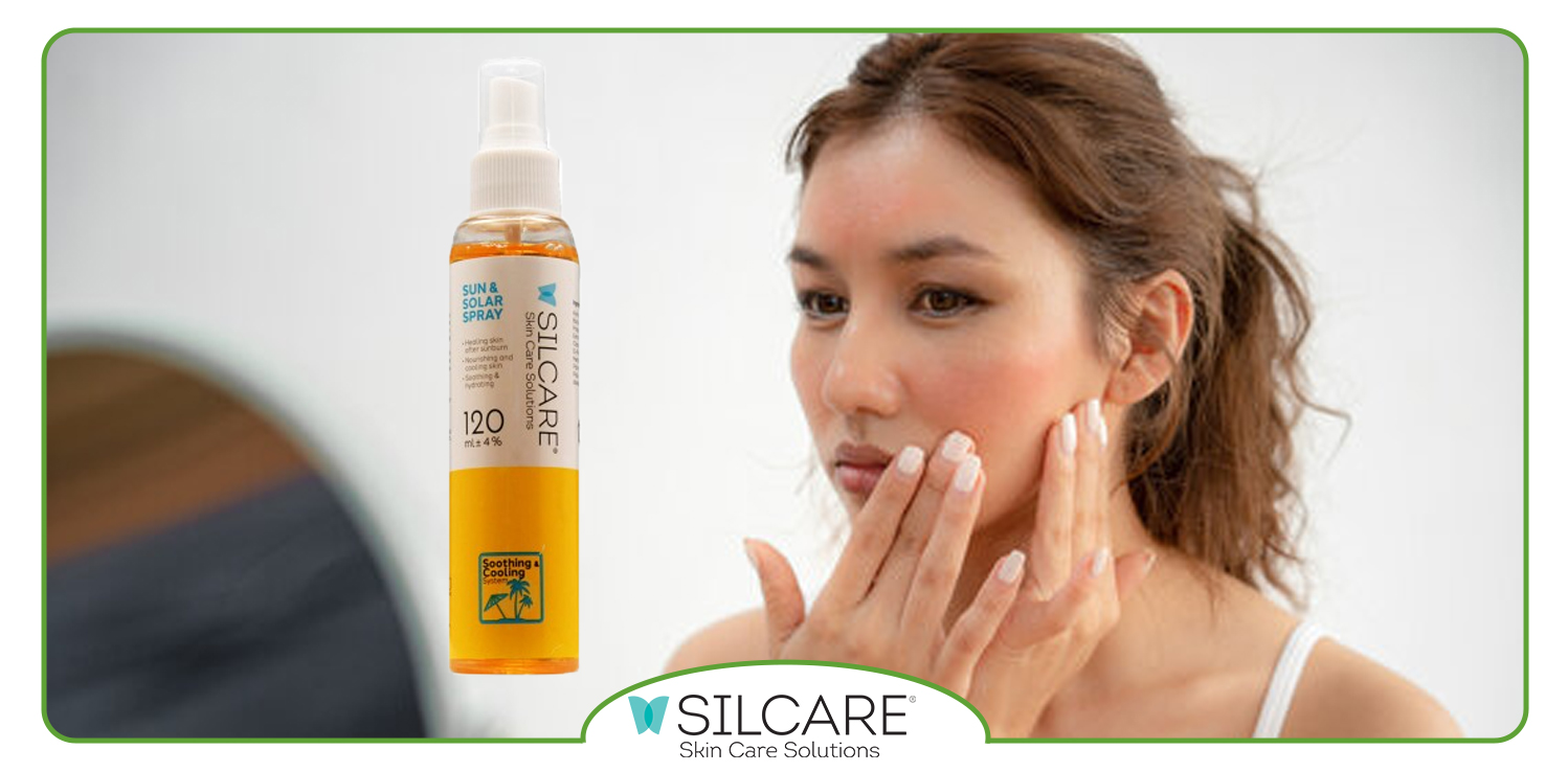 ترکیبات دیگر اسپری آفتاب سیلکر برای کاهش التهابات