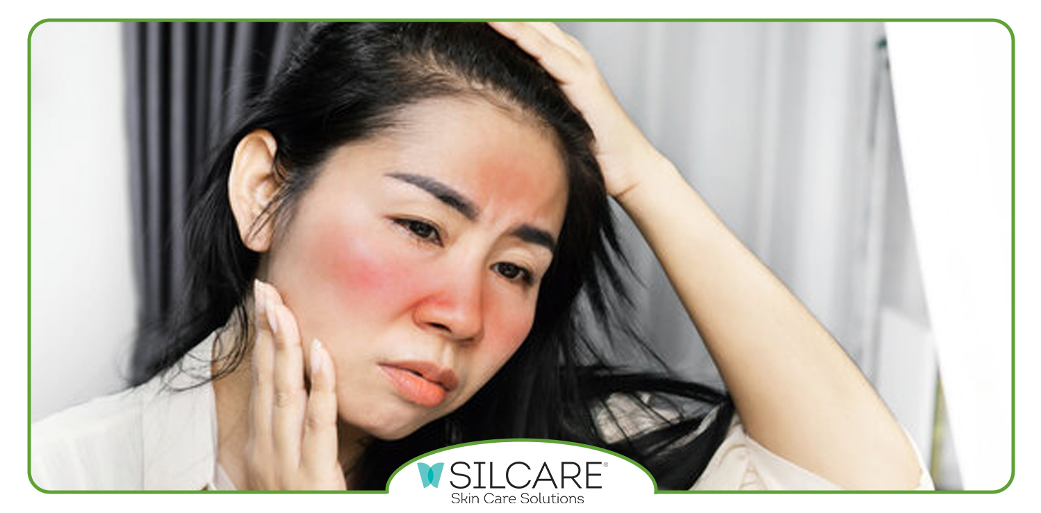 ترکیبات موثر برای کاهش التهاب در اسپری آفتاب و سولار سیلکر