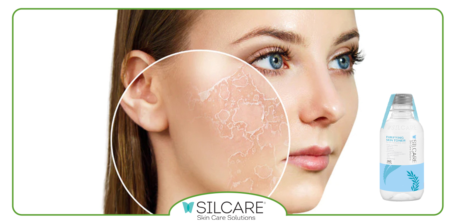 تونر مناسب پوست خشک