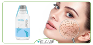 کدام ترکیبات تونر برای پوست خشک ضروری اند؟