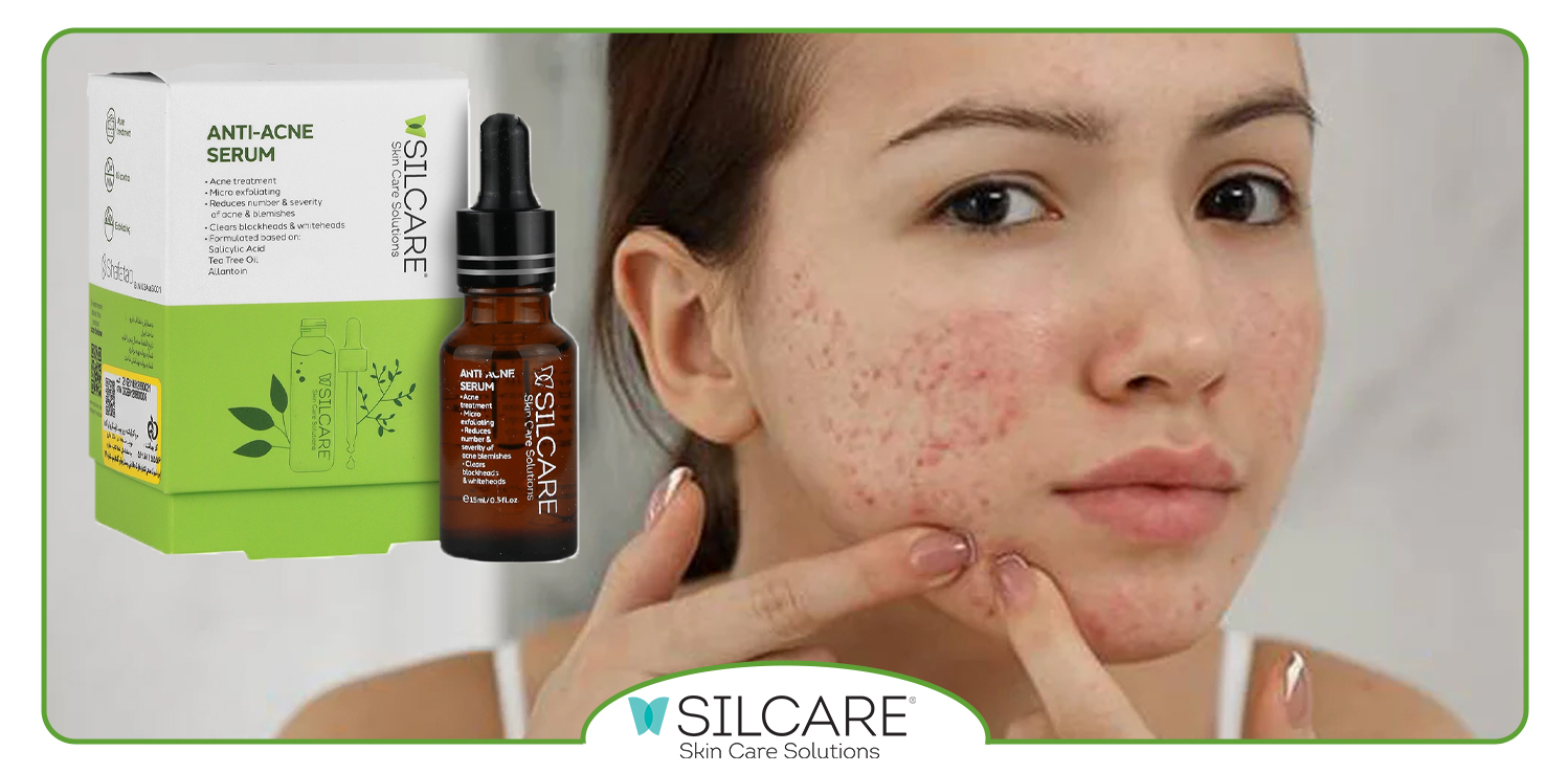 داروها و استرس چگونه پوست را چرب می کنند؟