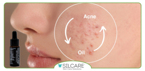 روتین ۴ مرحله ‌ای با سرم کنترل چربی برای پوست جوش‌ دار