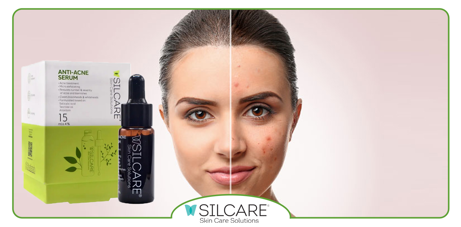 فرمولاسیون سرم ضد جوش سیلکر