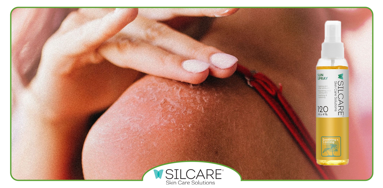 فواید اسپری آفتاب سوختگی سیلکر