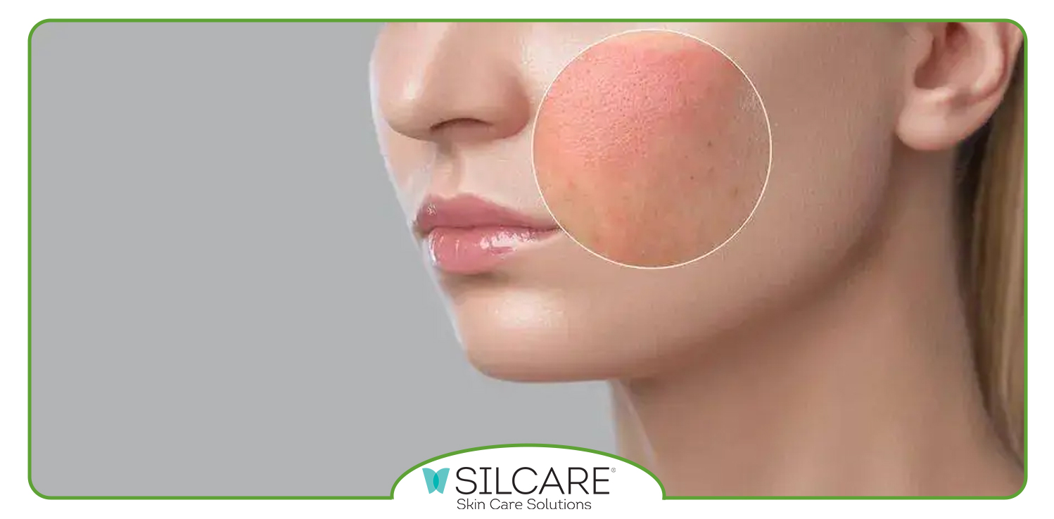 مراقبت ها در استفاده از اسپری ترمیم سیلکر