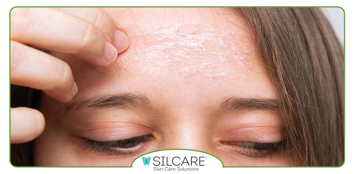 مزایای استفاده از ژل شستشوی صورت چرب و جوشدار