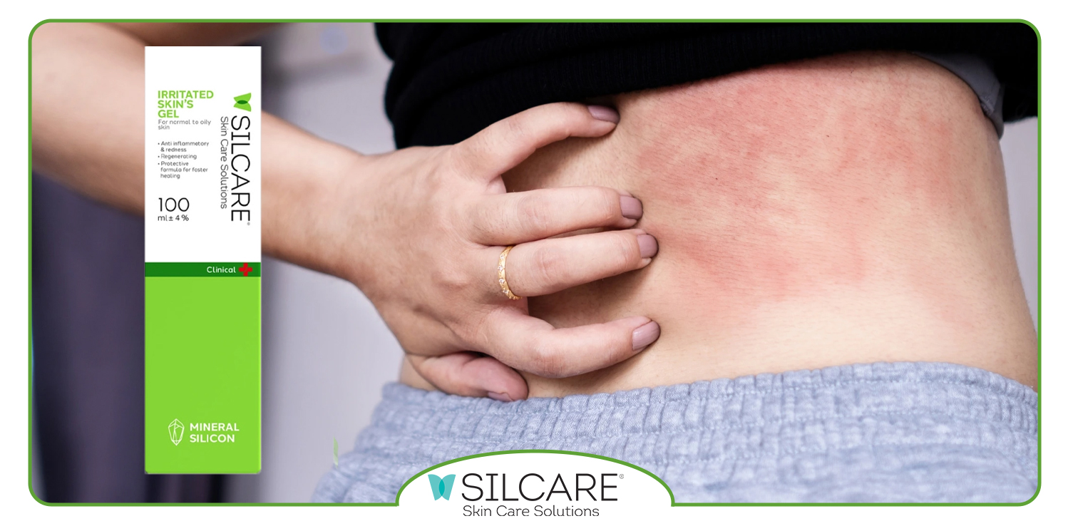 مزایای ژل ترمیم کننده پوست سیلکر